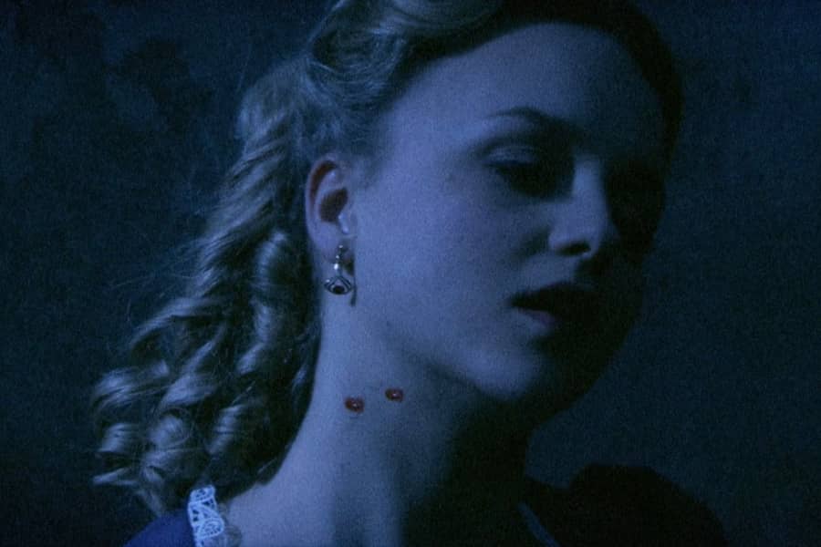 young woman has two bite marks on her neck