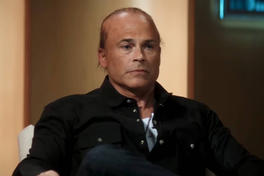 Rob Lowe reveals a bald head with random wispy long hairs