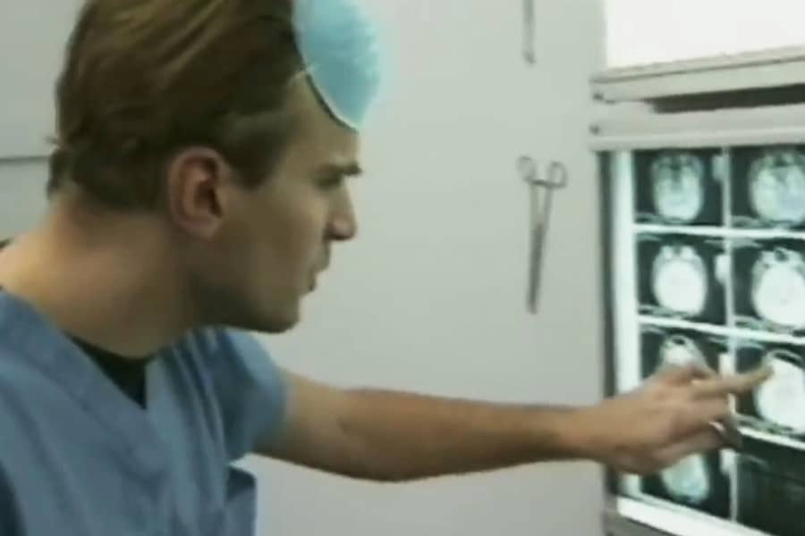 a doctor points at some x-rays of a brain